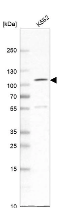 Western blot analysis in human cell line K562.