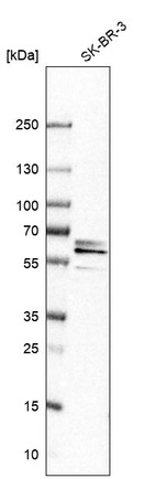 Western blot analysis in human cell line SK-BR-3.