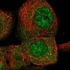 Immunofluorescent staining of human cell line A-431 shows localization to nucleoplasm & cytosol.