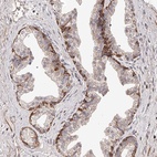Anti-ZNF502 Antibody
