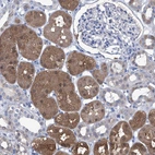 Immunohistochemical staining of human kidney shows strong cytoplasmic positivity in cells in proximal tubules.