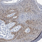 Immunohistochemical staining of human skin shows moderate cytoplasmic positivity in squamous epithelial cells.