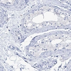 Immunohistochemical staining of human testis shows no cytoplasmic positivity in cells in seminiferous ducts as expected.