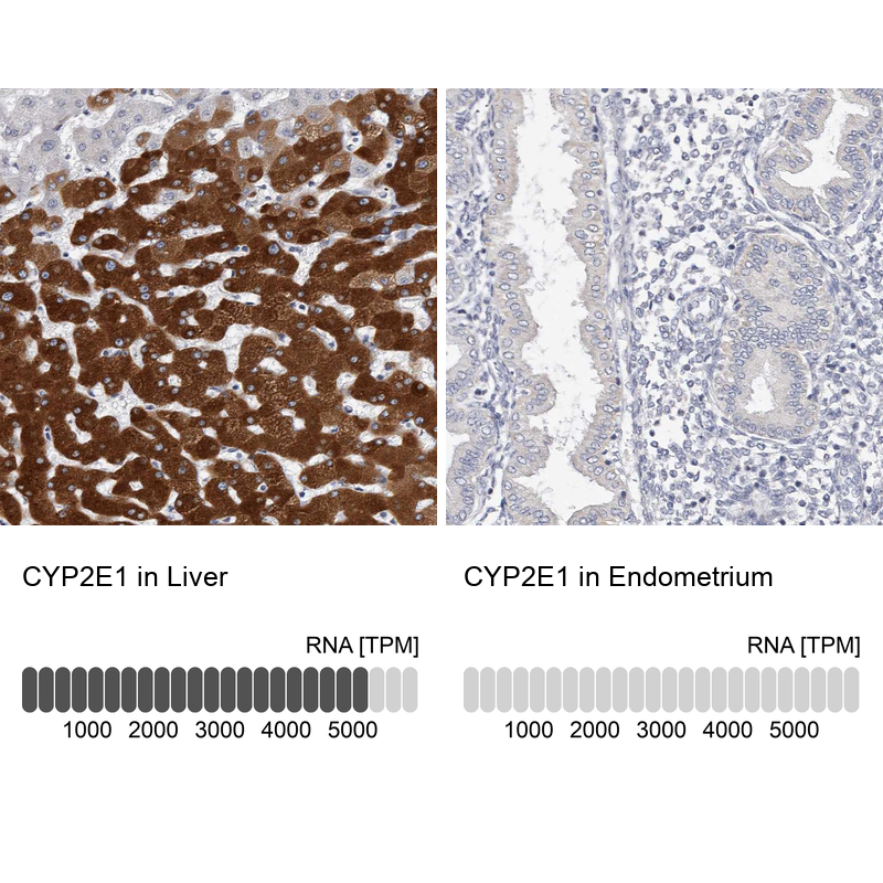 Anti-CYP2E1 Antibody