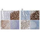 Immunohistochemical staining of human endometrium, liver, liver cancer and tonsil using Anti-CYP2E1 antibody HPA029564 (A) shows similar protein distribution across tissues to independent antibody HPA009128 (B).