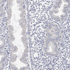 Immunohistochemical staining of human endometrium shows no positivity in glandular cells as expected.