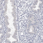 Immunohistochemical staining of human endometrium shows no positivity in glandular cells as expected.