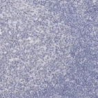 Immunohistochemical staining of human tonsil shows no positivity in germinal center cells as expected.