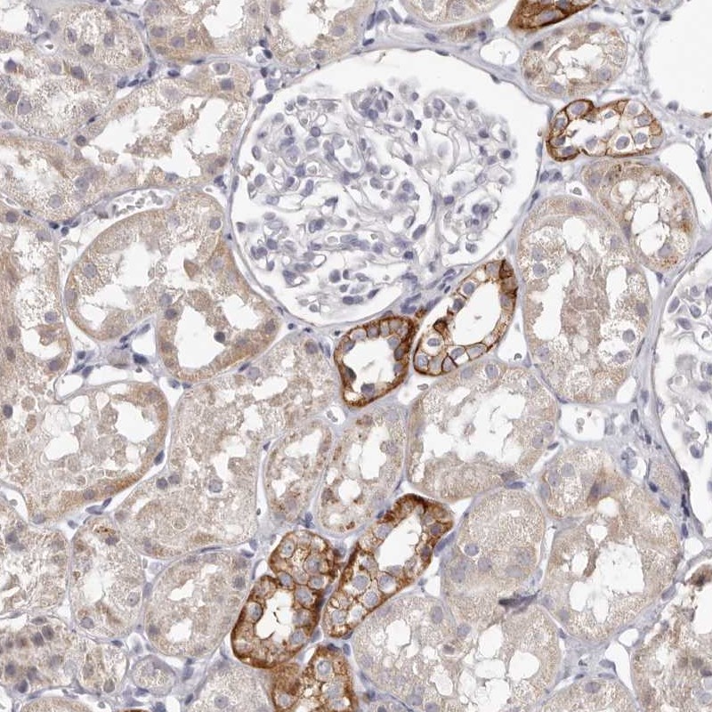 Anti-PCDHB6 Antibody