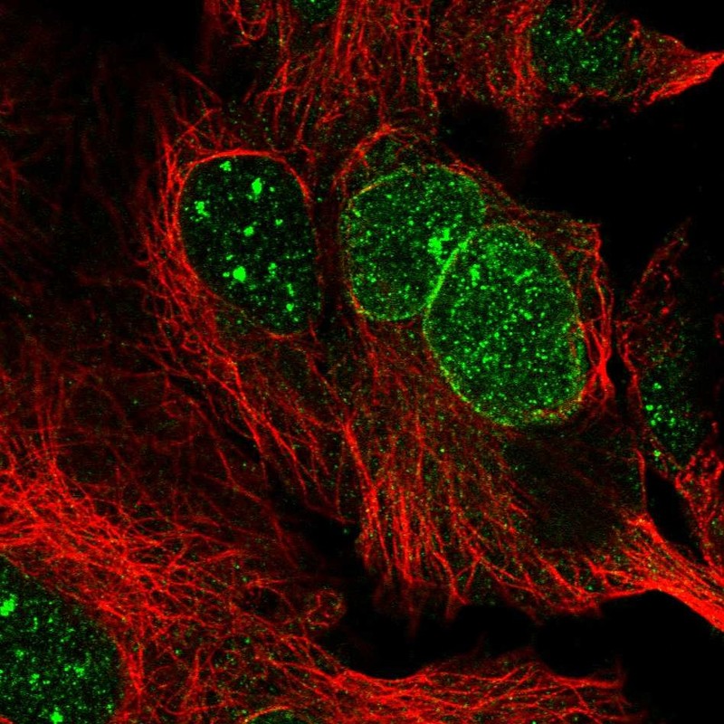 Anti-RANBP17 Antibody