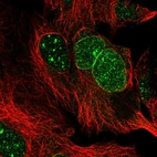 Anti-RANBP17 Antibody