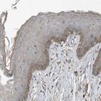 Immunohistochemical staining of human Skin shows moderate cytoplasmic positivity in squamous epithelial cells.
