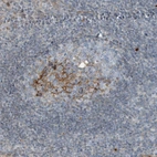 Immunohistochemical staining of human Tonsil shows moderate cytoplasmic positivity in germinal center cells.