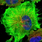 Immunofluorescent staining of human cell line U-251 MG shows localization to plasma membrane & cytosol.