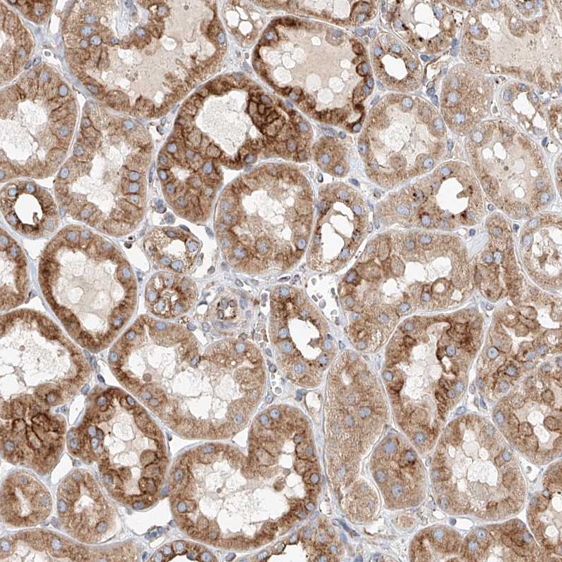 Anti-HGSNAT Antibody