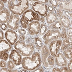 Anti-HGSNAT Antibody