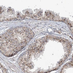 Immunohistochemical staining of human prostate shows strong granular cytoplasmic positivity in glandular cells.
