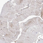 Immunohistochemical staining of human skeletal muscle shows very weak positivity in myocytes as expected.