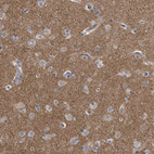 Anti-PCLO Antibody
