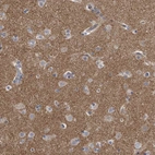 Anti-PCLO Antibody