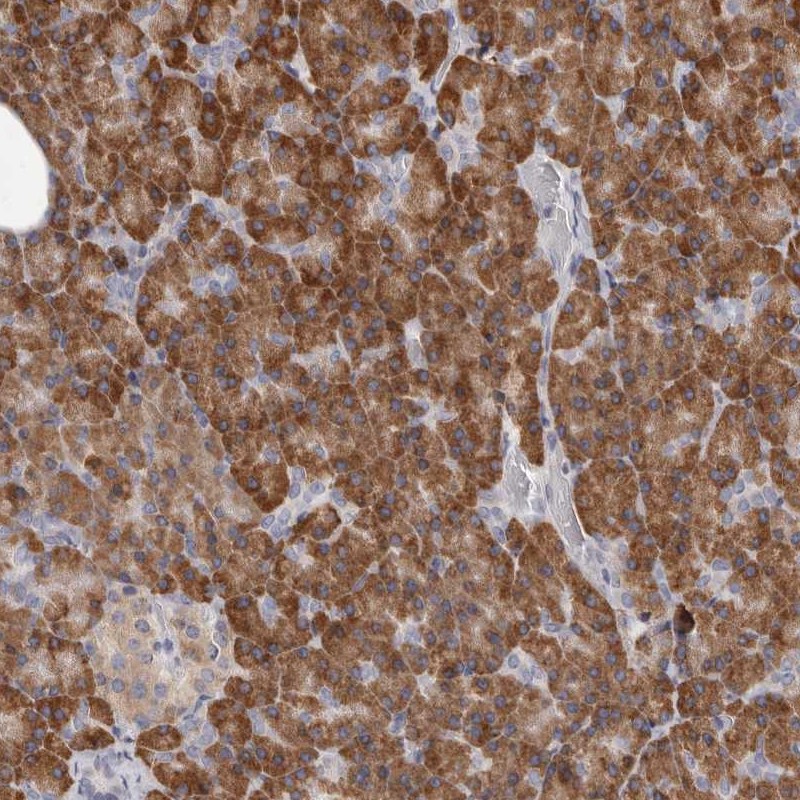 Anti-QRSL1 Antibody