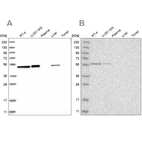 Western blot analysis using Anti-QRSL1 antibody HPA029585 (A) shows similar pattern to independent antibody HPA029587 (B).