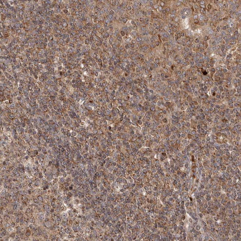 Anti-QRSL1 Antibody