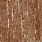 Immunohistochemical staining of human skeletal muscle shows strong cytoplasmic positivity in myocytes.