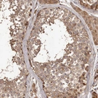 Immunohistochemical staining of human testis shows moderate granular cytoplasmic positivity in cells in seminiferous ducts.