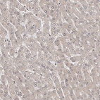 Immunohistochemical staining of human liver shows low positivity in hepatocytes as expected.