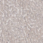 Immunohistochemical staining of human liver shows low positivity in hepatocytes as expected.