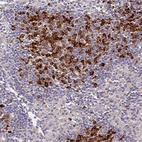 Anti-SLC11A1 Antibody