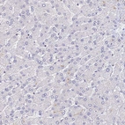 Immunohistochemical staining of human liver shows no positivity in hepatocytes as expected.
