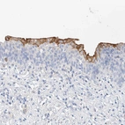 Anti-SBSPON Antibody