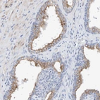 Immunohistochemical staining of human prostate shows strong cytoplasmic positivity in glandular cells.