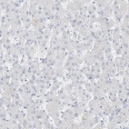 Immunohistochemical staining of human liver shows no positivity in hepatocytes as expected.