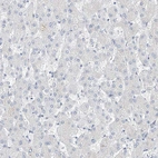 Immunohistochemical staining of human liver shows no positivity in hepatocytes as expected.