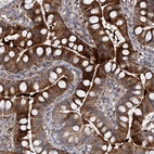 Anti-USP45 Antibody