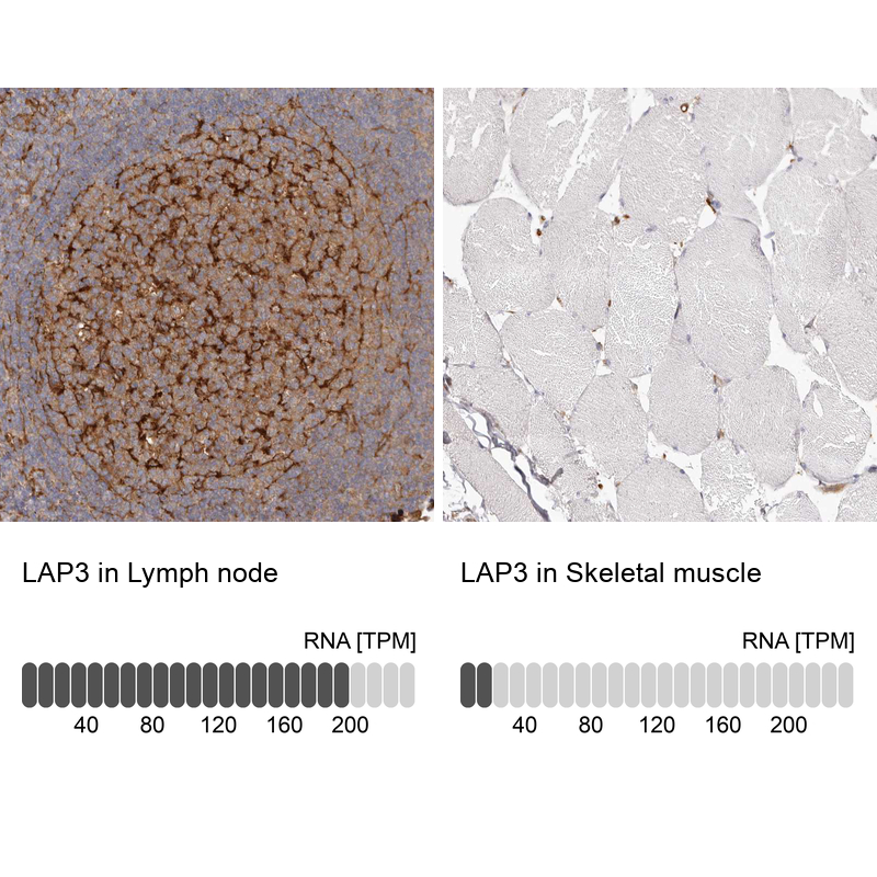 Anti-LAP3 Antibody
