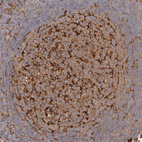 Immunohistochemical staining of human lymph node shows strong cytoplasmic positivity in germinal center cells.