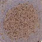 Immunohistochemical staining of human lymph node shows strong cytoplasmic positivity in germinal center cells.