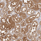Immunohistochemical staining of human kidney shows moderate cytoplasmic positivity in cells in tubules.