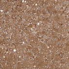 Immunohistochemical staining of human liver shows moderate cytoplasmic positivity in hepatocytes.