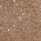 Immunohistochemical staining of human liver shows moderate cytoplasmic positivity in hepatocytes.