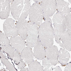 Immunohistochemical staining of human skeletal muscle shows no positivity in myocytes as expected.