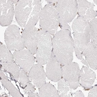 Immunohistochemical staining of human skeletal muscle shows no positivity in myocytes as expected.