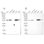 Western blot analysis using Anti-LAP3 antibody HPA029606 (A) shows similar pattern to independent antibody HPA029607 (B).