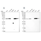Western blot analysis using Anti-LAP3 antibody HPA029606 (A) shows similar pattern to independent antibody HPA029607 (B).