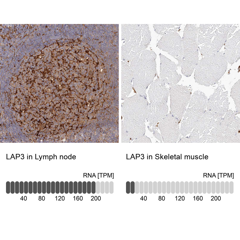 Anti-LAP3 Antibody