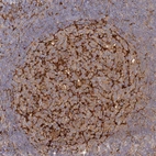 Immunohistochemical staining of human lymph node shows strong cytoplasmic positivity in germinal center cells.